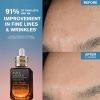 Advanced Night Repair Serum Synchronized Multi-Recovery Complex Recensioner